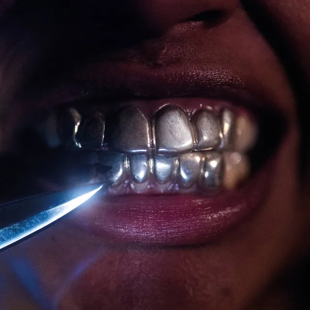 Upchuck – "I'm Nice Now"